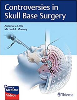 Controversies in Skull Base Surgery (EPUB)