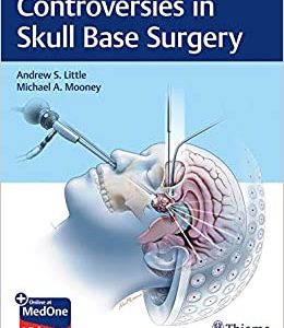 Controversies in Skull Base Surgery (EPUB)