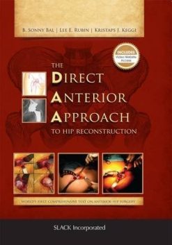 The Direct Anterior Approach to Hip Reconstruction (PDF)