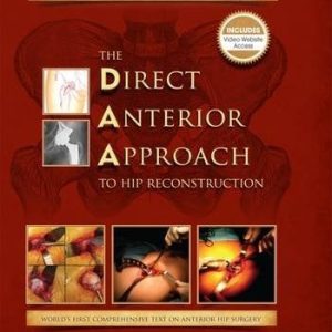 The Direct Anterior Approach to Hip Reconstruction (PDF)