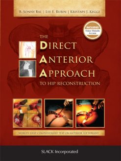 The Direct Anterior Approach to Hip Reconstruction (Original PDF from Publisher)