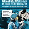 Illustrated Advanced Anterior Segment Surgery: A Step-by-Step Guide for Challenging Cases (Original PDF from Publisher)