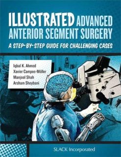 Illustrated Advanced Anterior Segment Surgery: A Step-by-Step Guide for Challenging Cases (Original PDF from Publisher)
