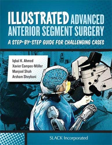 Illustrated Advanced Anterior Segment Surgery: A Step-by-Step Guide for Challenging Cases (Original PDF from Publisher)