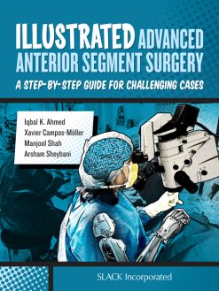Illustrated Advanced Anterior Segment Surgery (EPUB)