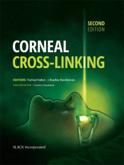 Corneal Cross-Linking, 2nd Edition (Original PDF from Publisher)