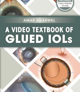 A Video Textbook of Glued IOLs