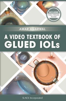 A Video Textbook of Glued IOLs