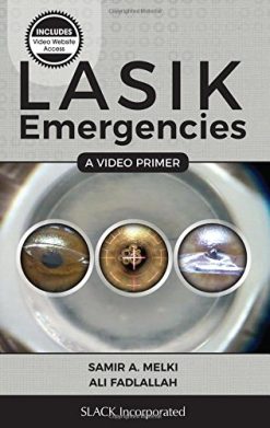 LASIK Emergencies: A Video Primer