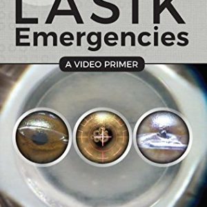 LASIK Emergencies: A Video Primer