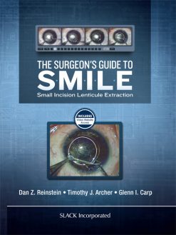 The Surgeon’s Guide to SMILE (Original PDF from Publisher)