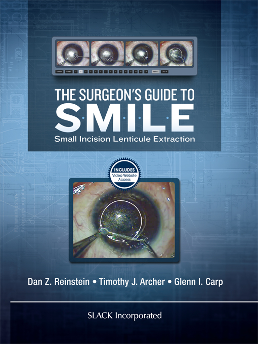 The Surgeon’s Guide to SMILE (Original PDF from Publisher)