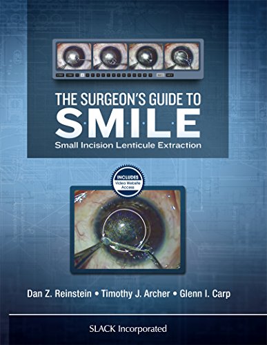 The Surgeon’s Guide to SMILE: Small Incision Lenticule Extraction (PDF)