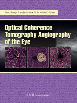 Optical Coherence Tomography Angiography of the Eye (Original PDF from Publisher)
