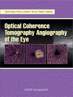 Optical Coherence Tomography Angiography of the Eye (EPUB)