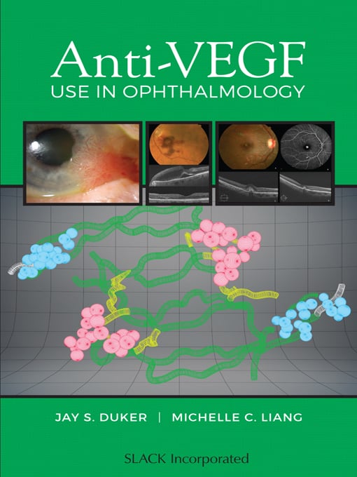 Anti-VEGF Use in Ophthalmology (EPUB)