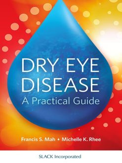 Dry Eye Disease: A Practical Guide (Original PDF from Publisher)