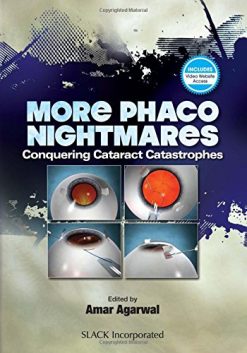 More Phaco Nightmares: Conquering Cataract Catastrophes (EPUB)