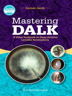 Mastering DALK: A Video Textbook on Deep Anterior Lamellar Keratoplasty (EPUB)