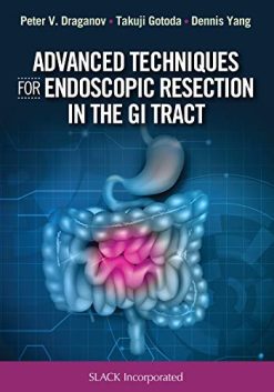 Advanced Techniques for Endoscopic Resection in the GI Tract (EPUB)