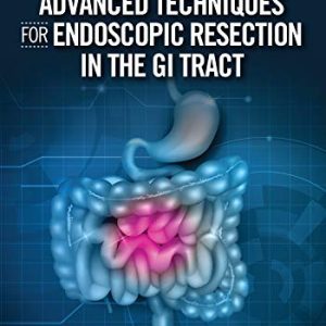 Advanced Techniques for Endoscopic Resection in the GI Tract (EPUB)