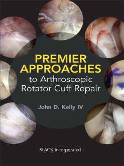 Premier Approaches to Arthroscopic Rotator Cuff Repair (EPUB)