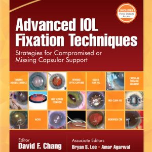 Advanced IOL Fixation Techniques: Strategies for Compromised or Missing Capsular Support (Original PDF from Publisher)