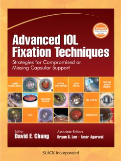 Advanced IOL Fixation Techniques: Strategies for Compromised or Missing Capsular Support (EPUB)