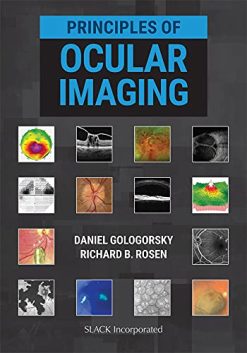 Principles of Ocular Imaging (Original PDF from Publisher)