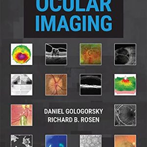 Principles of Ocular Imaging (Original PDF from Publisher)