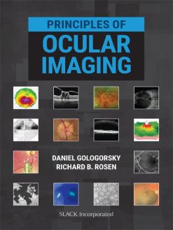 Principles of Ocular Imaging (EPUB)