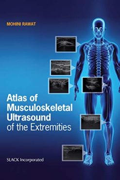 Atlas of Musculoskeletal Ultrasound of the Extremities (Original PDF from Publisher)