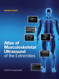 Atlas of Musculoskeletal Ultrasound of the Extremities (EPUB)