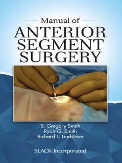 Manual of Anterior Segment Surgery (EPUB)