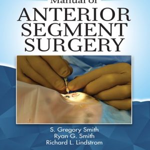 Manual of Anterior Segment Surgery (EPUB)