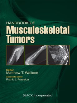 Handbook of Musculoskeletal Tumors (EPUB)