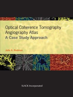 Optical Coherence Tomography Angiography Atlas (Original PDF from Publisher)