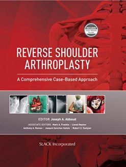 Reverse Shoulder Arthroplasty: A Comprehensive Case-Based Approach (Original PDF from Publisher)