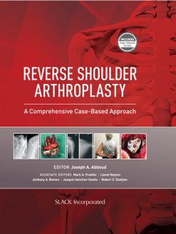 Reverse Shoulder Arthroplasty: A Comprehensive Case-Based Approach (EPUB)