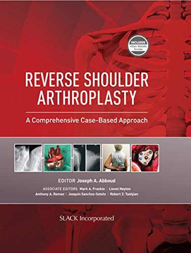Reverse Shoulder Arthroplasty: A Comprehensive Case-Based Approach (Original PDF from Publisher)