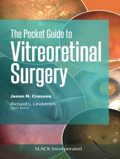 Pocket Guide to Vitreoretinal Surgery (EPUB)