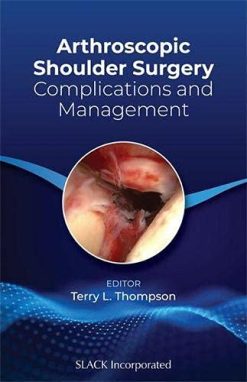 Arthroscopic Shoulder Surgery: Complications and Management (Original PDF from Publisher)