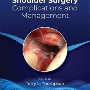 Arthroscopic Shoulder Surgery: Complications and Management (Original PDF from Publisher)