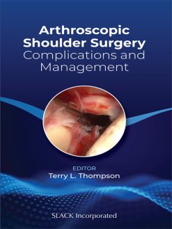 Arthroscopic Shoulder Surgery: Complications and Management (EPUB)