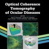 Optical Coherence Tomography of Ocular Diseases, 4th Edition (Original PDF from Publisher)