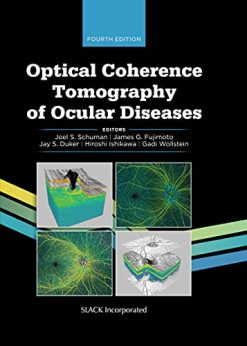 Optical Coherence Tomography of Ocular Diseases, 4th Edition (Original PDF from Publisher)