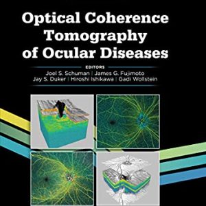 Optical Coherence Tomography of Ocular Diseases, 4th Edition (Original PDF from Publisher)