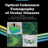 Optical Coherence Tomography of Ocular Diseases, 4th Edition (EPUB)