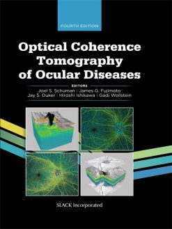 Optical Coherence Tomography of Ocular Diseases, 4th Edition (EPUB)