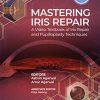 Mastering Iris Repair: A Video Textbook of Iris Repair and Pupilloplasty Techniques (Original PDF from Publisher)